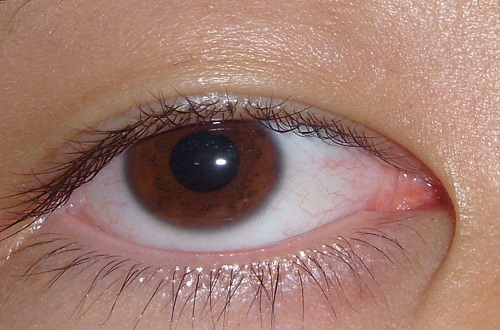 眼睛有红血丝是什么原因