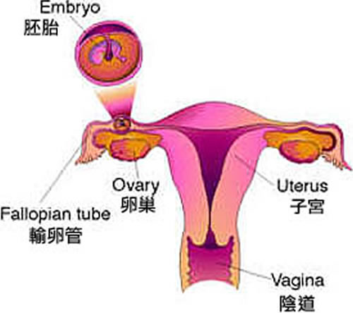 什么是宫外孕（什么是宫外孕可以生吗）