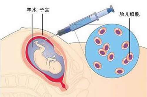 羊水穿刺什么时候做（羊水穿刺什么时候做最安全）