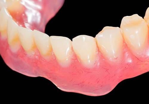 假牙怎么清洗(活动假牙怎么清洗)