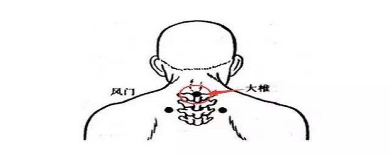 大椎的位置在哪里 大椎在什么位置示意图