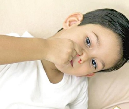 小孩流鼻血的原因 小孩流鼻血的原因有哪些