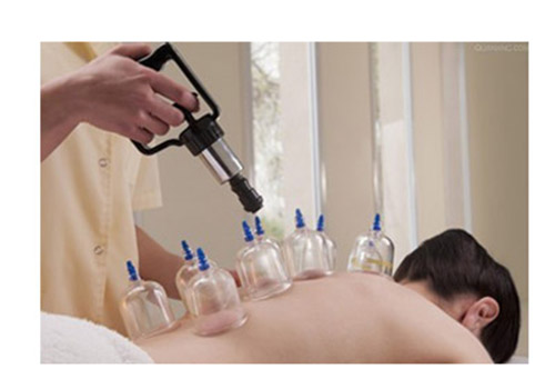 中暑可以拔罐吗 孕妇中暑可以拔罐吗