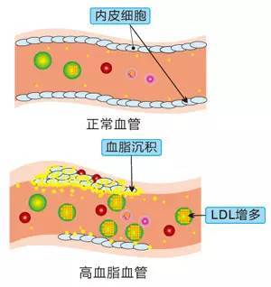 吃什么软化血管最好