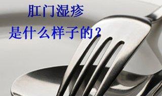 肛门湿疹怎么办 要怎样治疗？