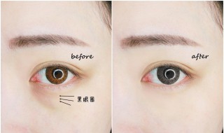 眼袋黑眼圈怎么造成的 眼袋和黑眼圈是形成原因