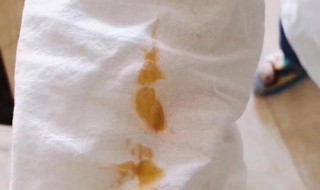 白衬衫弄到油了怎么办 白衬衫弄到油了怎么办能洗掉吗