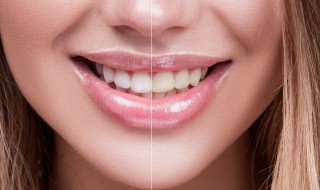 正确的牙齿增白方法 正确的牙齿增白方法视频
