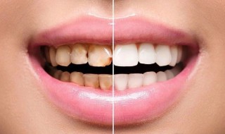 白牙的最快方法有效 白牙的最快方法有效止痛