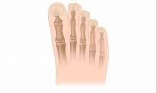 趾骨是哪个位置 右足第一趾骨是哪个位置