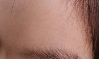 额头上有汗毛怎么去除 额头上的汗毛可以刮掉吗