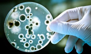 保存细菌等菌种最佳方法 微生物菌种保存方法有哪些