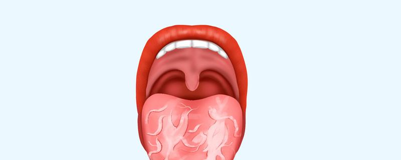 裂纹舌怎么治疗 严重的裂纹舌怎么治疗