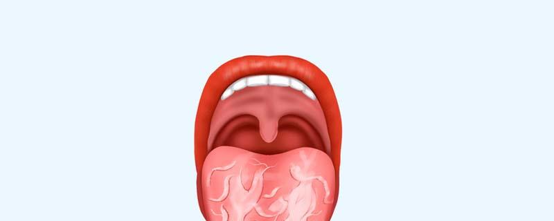 裂纹舌不能吃什么东西 舌头有裂纹不能吃什么