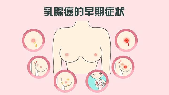 如何选择适合自己的内衣 如何选择适合自己的内衣杯型