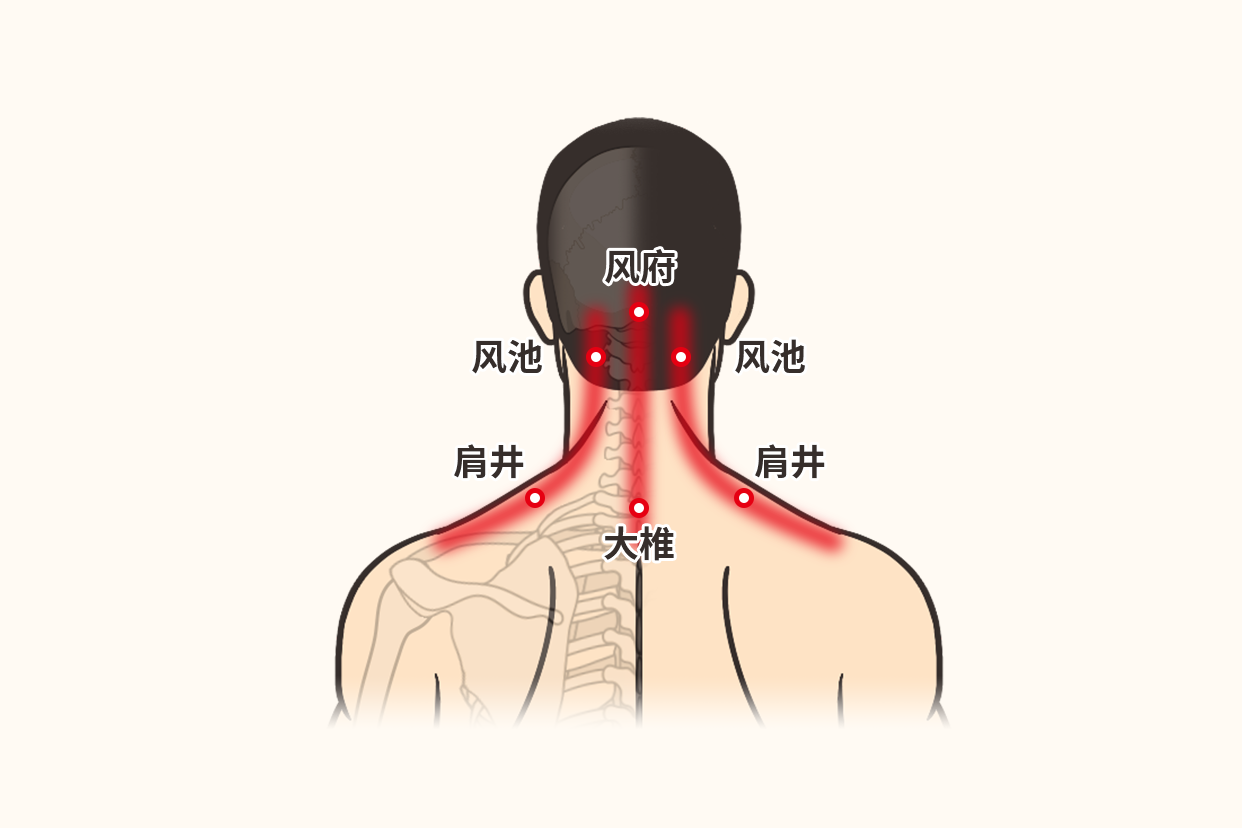 感冒头痛刮痧刮什么部位图 感冒头疼刮痧图解