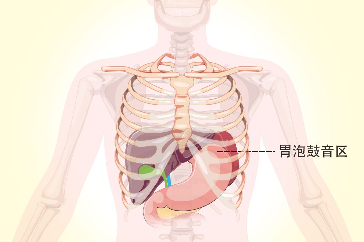 胃泡鼓音区示意图 胃泡鼓音区形成原因