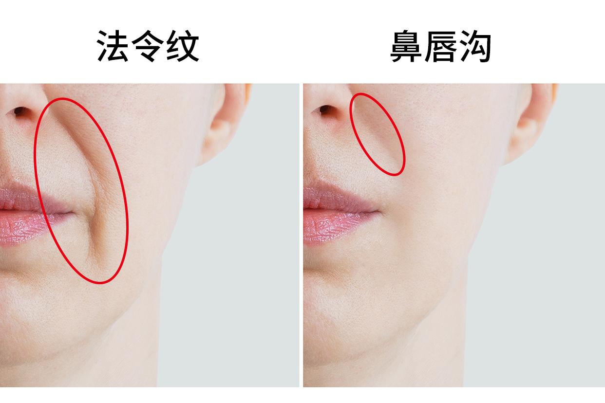 法令纹和鼻唇沟的区别图片（法令纹鼻唇沟在面部哪个部位）