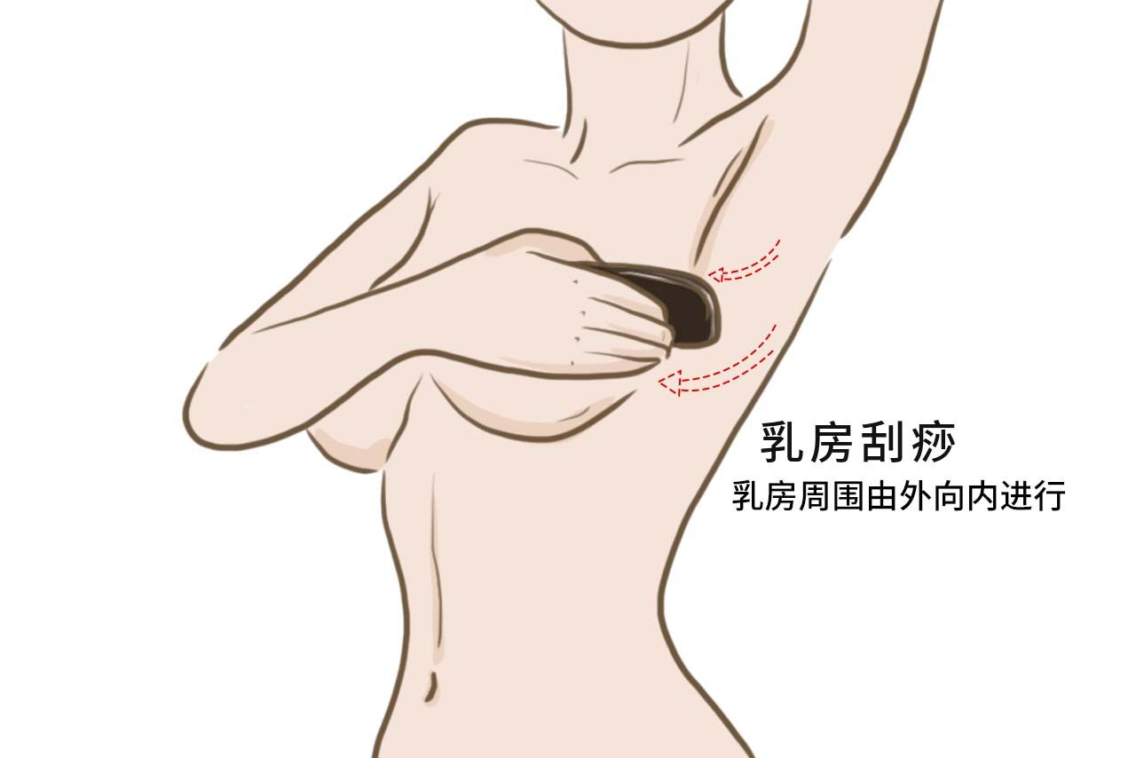 乳房刮痧图解