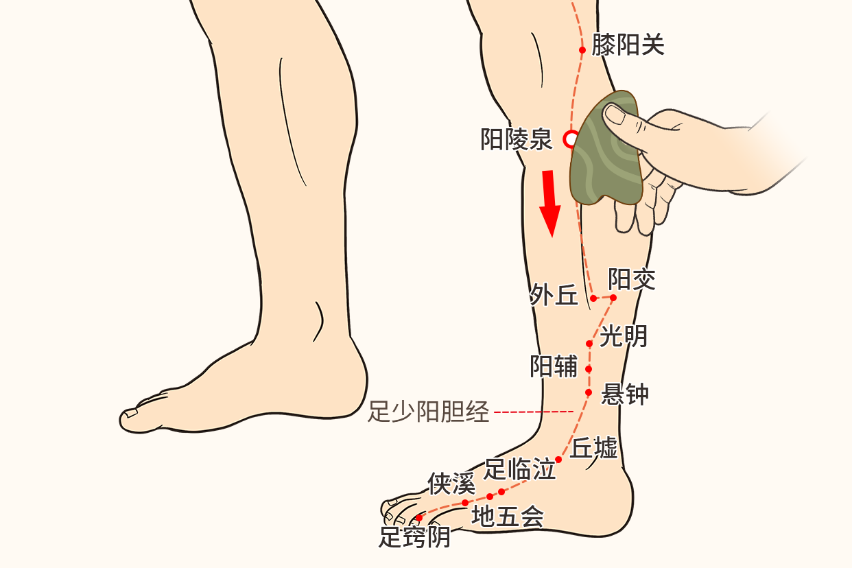 肝胆湿热刮痧示意图