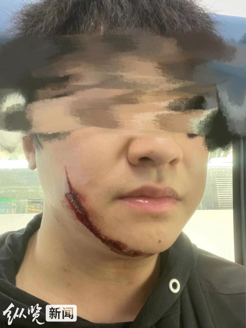 重庆一农业执法人员与人发生口角后当街持菜刀伤人，伤者家人：施暴者仍在正常上班