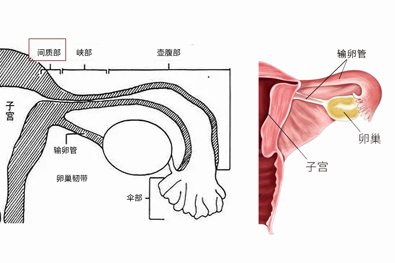 输卵管间质部图片 输卵管间质部是什么位置